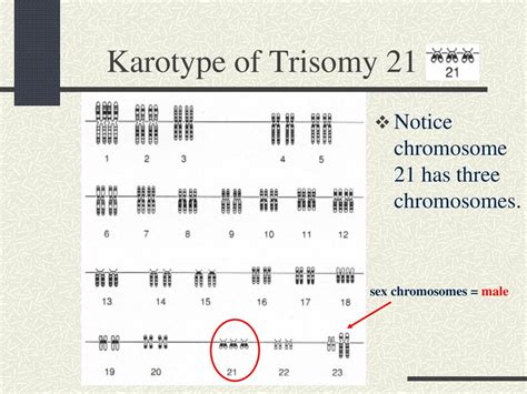 Chromosomes As A Eukaryotic Cell Prepares To Divide The Dna Ppt Download