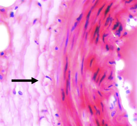 Blood Vessel Histology Flashcards Quizlet