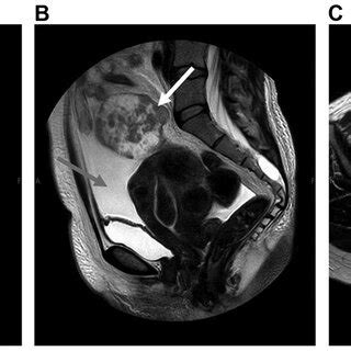 T Weighted Pelvic Magnetic Resonance Imaging A And B Sagittal And