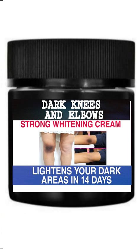 Dark Knees Lightening Cream Dark Elbows Cream Dark Spots | Etsy