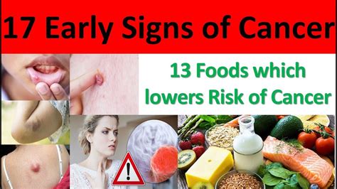 17 Cancer Symptoms You Shouldn't Ignore | Cancer Early Signs | 13 Foods which Lowers Risk of ...