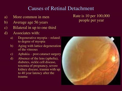 Ppt Acute Vision Loss Powerpoint Presentation Free Download Id 3000924