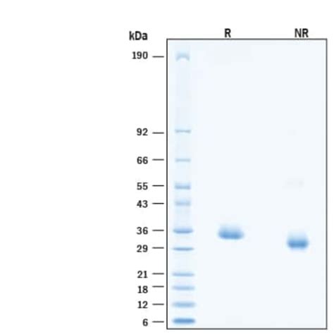 R Recombinant SARS CoV 2 AV 1 Spike RBD His tag Protein CF 100 μg