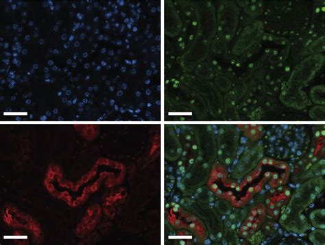 Hepatocyte Nuclear Factor Homeobox B Hnf B Is Expressed In Distal