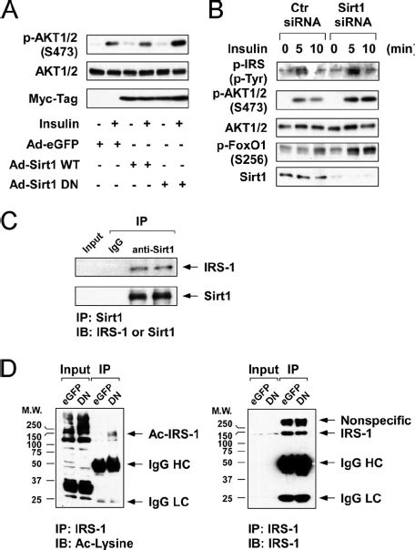 Irs Interacts With Sirt And Is Deacetylated By Sirt In Hypothalamic