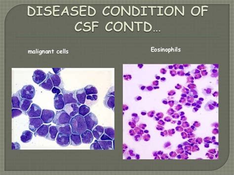 Cytology Of Csf