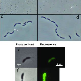 Electron Micrographs Of C Crescentus Wild Type And Mutant Cells