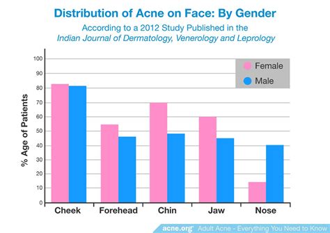 Adult Acne Everything You Need To Know