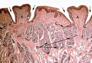 Oral Histology Digital Lab Mucosa Section Of Circumvallate Papillae