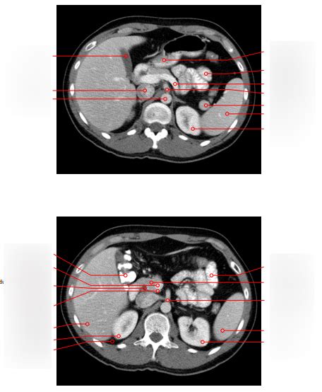 Diagram Radiologie Anatomie Abdomen Quizlet