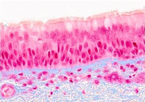 Epitelio pseudoestratificado cilindrico ciliado con células