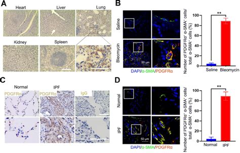 Distribution And Localization Of Pdgfrα In Fibrotic Lung Tissue And