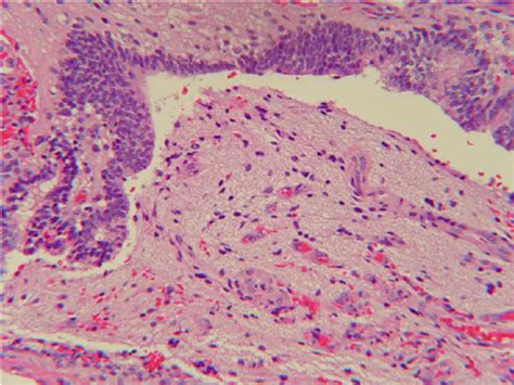 Ependyma-like cells around terminal ventricle-like space. | Download ...