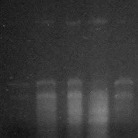 SDS PAGE Analysis Of Purified Chitinase Of R Stolonifer The Molecular