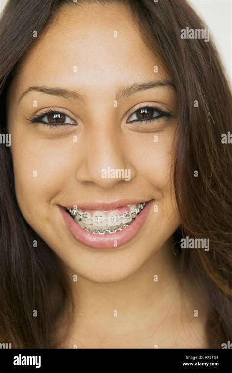 Cute Latina With Braces Ages Fan Photos Telegraph