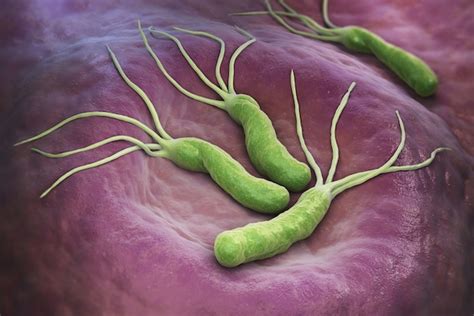 H Pylori como pega Clínica Gastrolife