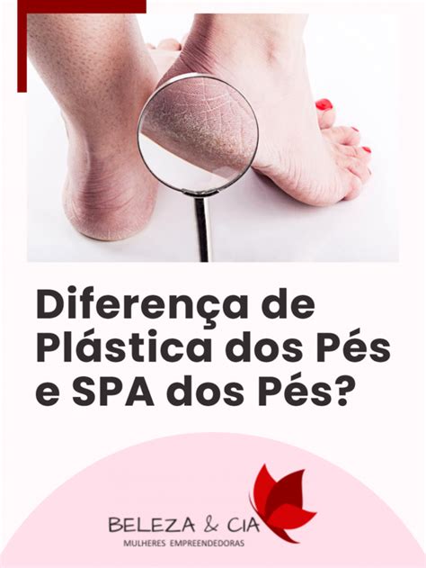 Diferença De Plástica Dos Pés E Spa Dos Pés Beleza E Cia