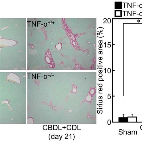 Tnf Deficiency Did Not Affect Hepatocyte Regeneration After