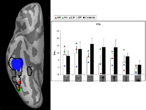 Face Specific Bold Activation In Right Fusiform Face Area Ffa When