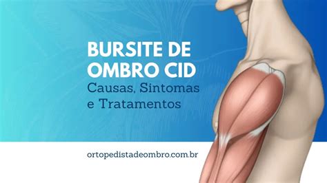 Bursite De Ombro Cid Causas Sintomas E Tratamento