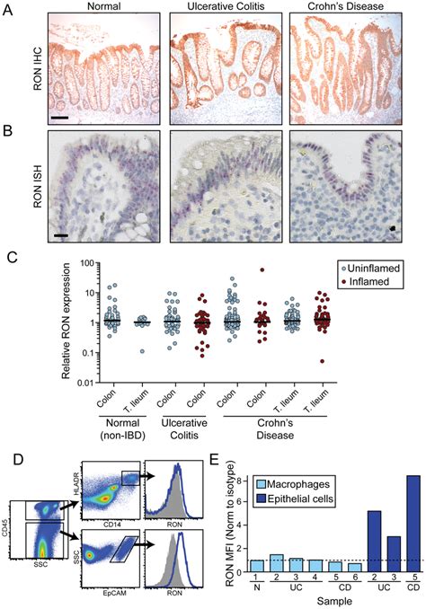 Ron Is Preferentially Expressed By Epithelial Cells In Human Tissues Download Scientific