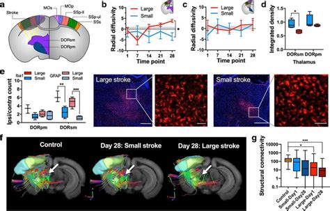 Lesion Size Dependent Secondary Degeneration Of Thalamocortical Fiber