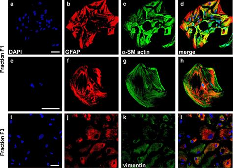 Expression Of Glial Fibrillary Acidic Protein Gfap Red And Smooth