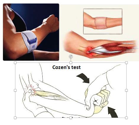 Nptae Musculoskeletal Pathologies Elbow Flashcards Quizlet