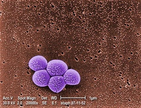 Methicillin Resistant Staphylococcus Aureus Mrsa Uses Our Bodys Fats