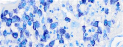 Toluidine Blue A Histology Stain For Mast Cells And Other Things