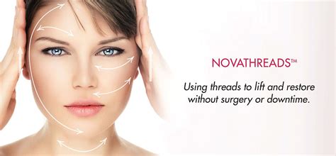 Novathreads Thread Lift