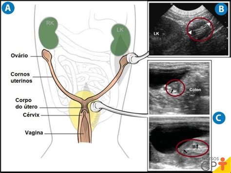 Localização Dos Ovarios - Como avaliar e identificar alterações nos ovários de cadelas e gatas ...