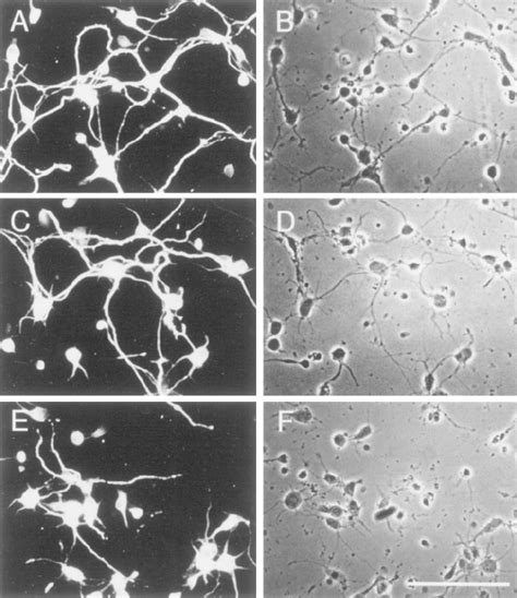 Effect Of Mek Inhibitor On Neurite Outgrowth Of Hippocampal Cells A