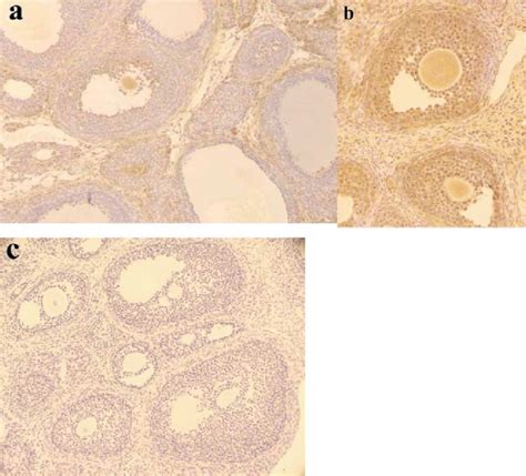 Micrographs Of Immature Rat Ovaries From Group B Showing Immune