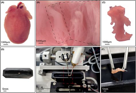 Contractility Detection Of Isolated Mouse Papillary Muscle Using