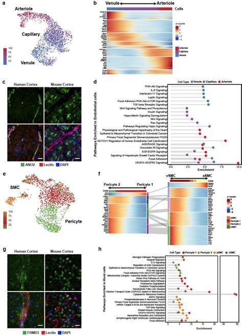 Figure 3 From Single Cell Dissection Of The Human Cerebrovasculature In