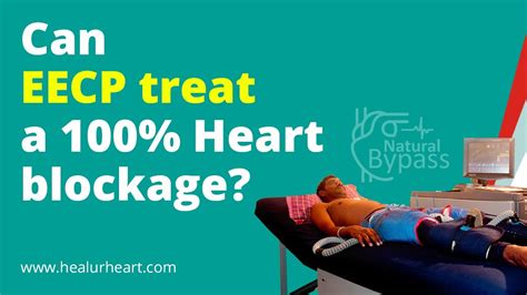 Can EECP Treat A 100 Heart Blockage YouTube