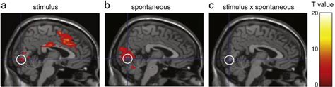 Linear Superposition Of Spontaneous And Evoked Activity A Brain