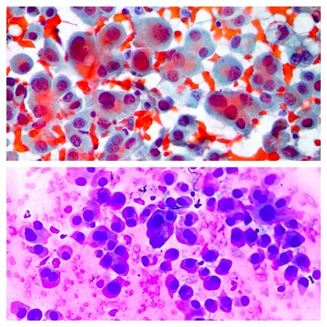 Lung Cytopathology Cellnetpathology