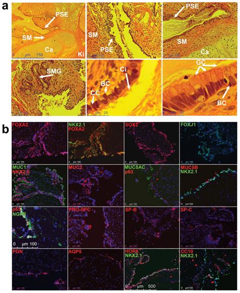 Efficient Generation Of Lung And Airway Epithelial Cells From Human