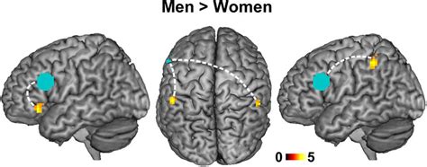 Functional Connectivity Within Encoding Circuitry By Sex Left Download Scientific Diagram