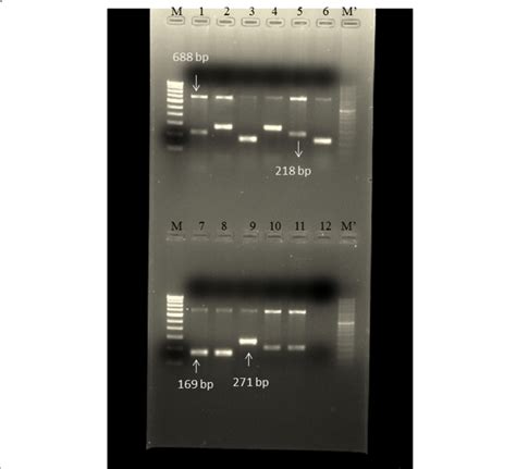 Amplified PCR Product Image Showing Amplified Products Of 16S RRNA And