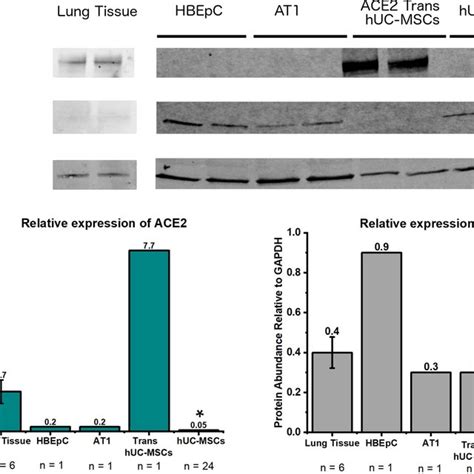 Immunofluorescent Staining Of Ace2 Tmprss2 And Nuclei For Primary Download Scientific Diagram