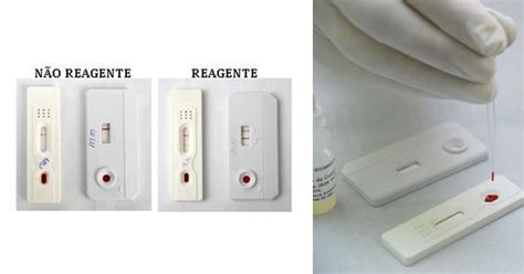 Teste R Pido Pode Detectar Hiv Em Apenas Minutos Pfarma