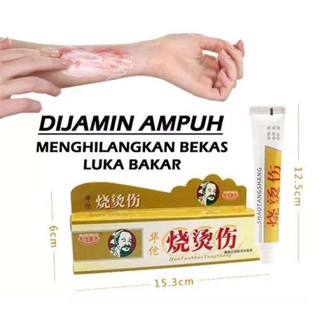 Promo SALEP PENGHILANG BEKAS LUKA BAKAR SALEP HERBAL CINA OBAT LUKA