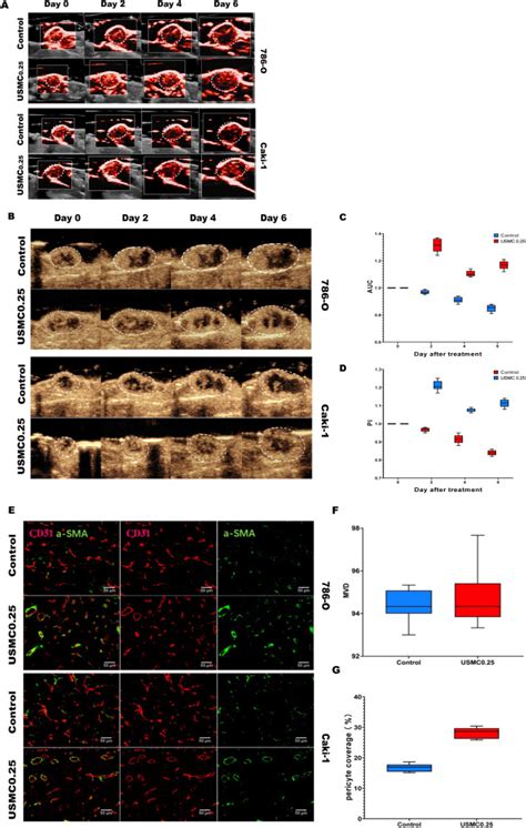 Enhancement Of Tumor Perfusion And Antiangiogenic Therapy In Murine