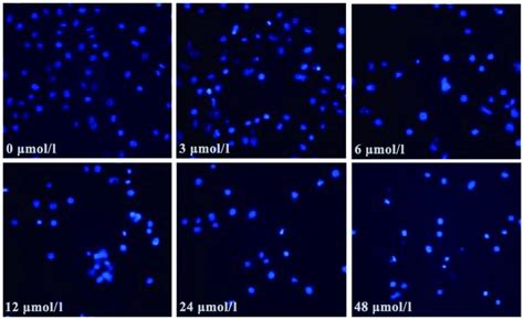 Evodiamine Inhibits Proliferation And Induces Apoptosis In Gastric