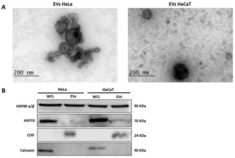 Characterization Of Evs Derived From Hela And Hacat Cells A