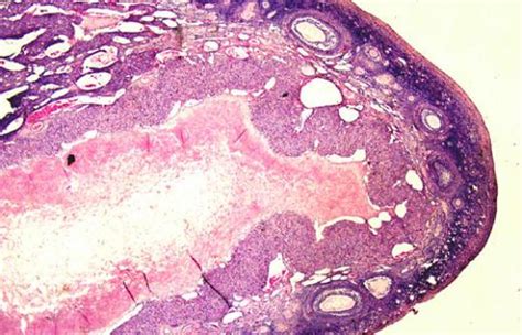 Ovary At Low Power Collection Of Histology Images