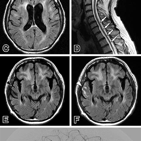 Figure1 Radiological Findings Of The Patient A B Magnetic Resonance